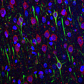 Cerbral cortex tissue,light micrograph