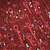 Cerebral cortex nerve cells