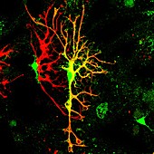 Brain nerve cells,light micrograph