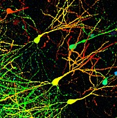 Mouse brain neurons,light micrograph
