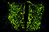 Fluorescence in rat brain cells