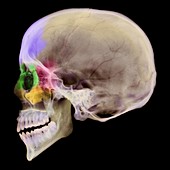 Paranasal sinuses,X-ray