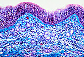 Nasal epithelium