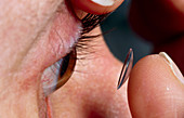 Close-up of hard contact lens being placed in eye