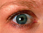 Close-up of a woman's blue eye