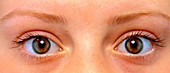 Pair of healthy brown eyes,female