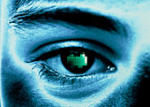 Coloured image of a man's eye with pixelated pupil