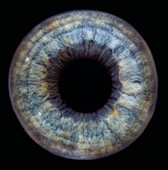 Iris of the eye