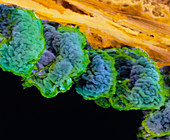Coloured SEM of ciliary processes of the eye