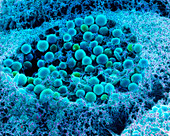 Col. SEM of eye melanocyte cell & pigment granules