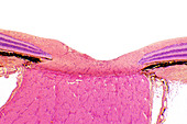 Optic nerve,light micrograph