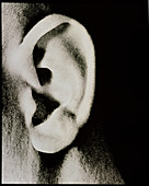 External view of a man's ear