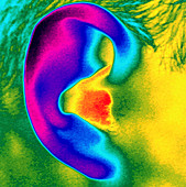 Thermogram of a close-up of a human ear