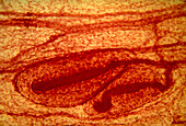 LM of pacinian corpuscles in human skin