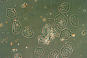 LM of epithelial cells from the human mouth