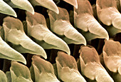 Coloured SEM of the radula of the garden slug