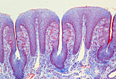 LM of papillae with taste buds on tongue surface
