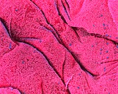 Coloured SEM of the surface of the tongue