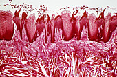 Tongue papillae,light micrograph