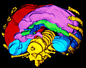False-colour,3-D CT scan of digestive viscera