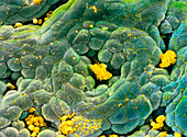 False-colour SEM of gastric gland in stomach