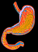 Artwork of the stomach