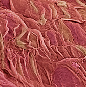 Oesophagus epithelium,SEM