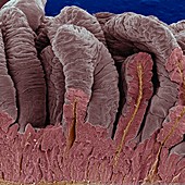 False-colour SEM of intestinal villi