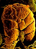Electron micrograph of villus in small intestine