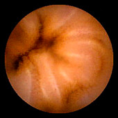 Jejunum,pill camera view