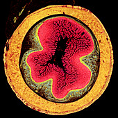 Small intestine,light micrograph