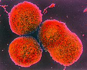 Coloured SEM of liver cells (hepatocytes)