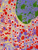 Colour TEM of islet of Langerhans cells