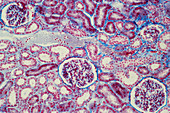 Lm of normal human kidney