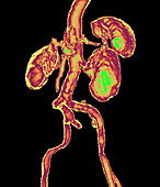 Human kidneys and spleen
