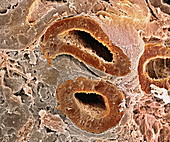 Kidney tubules,SEM