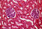 Kidney glomeruli,light micrograph