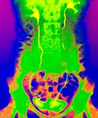 Colour X-ray of healthy kidneys,ureters,bladder