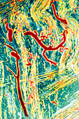 Bladder tissue,light micrograph