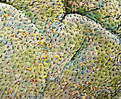 False-colour SEM of glandular wall of the colon