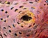 Coloured SEM of glandular surface of human colon
