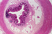 LM of a cross-section through the human appendix