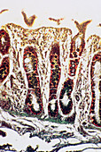 Intestinal villi,light micrograph