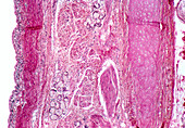 LM of human tracheal epithelium