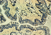 Light micrograph of human tracheal epithelium