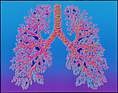 Computer art of human lung trachea & bronchioles