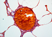 LM of human lung with blood vessel
