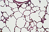 LM of a section of lung tissue
