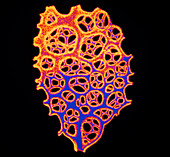 Illustration of human lung tissue showing alveoli