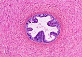 Light micrograph of a section of spermatic cord